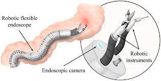 Towards a Snake-like Flexible Robot for Endoscopic Submucosal Dissection